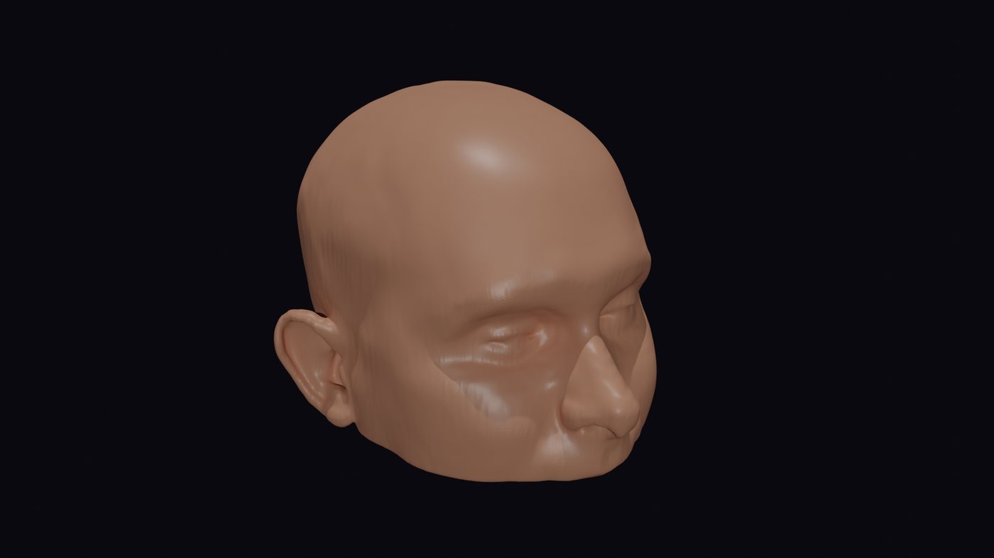 Soft tissue render showing a restored, natural forehead contour after implant placement