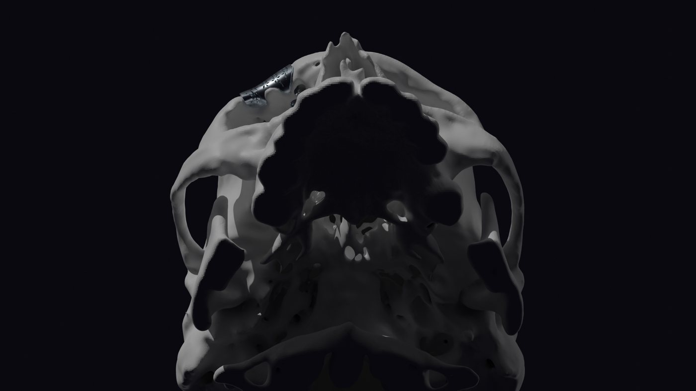 Inferior view of the skull showing the implant in place