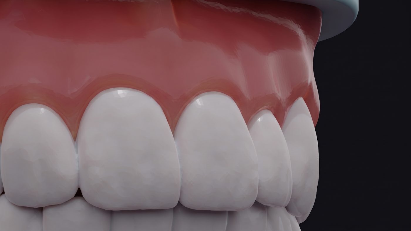 Close-up of the front teeth, surface and gumline detail