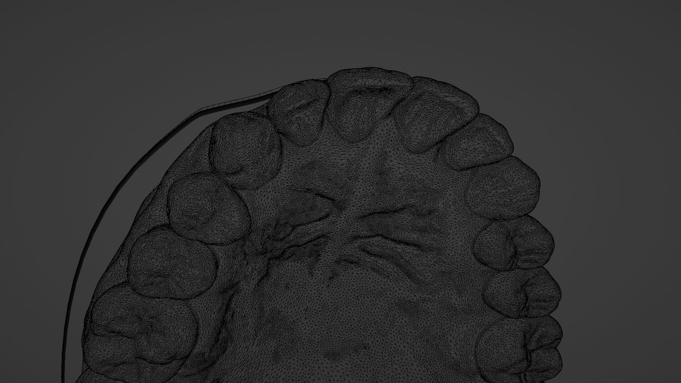 Close-up CAD mesh of the palate rugae before texturing