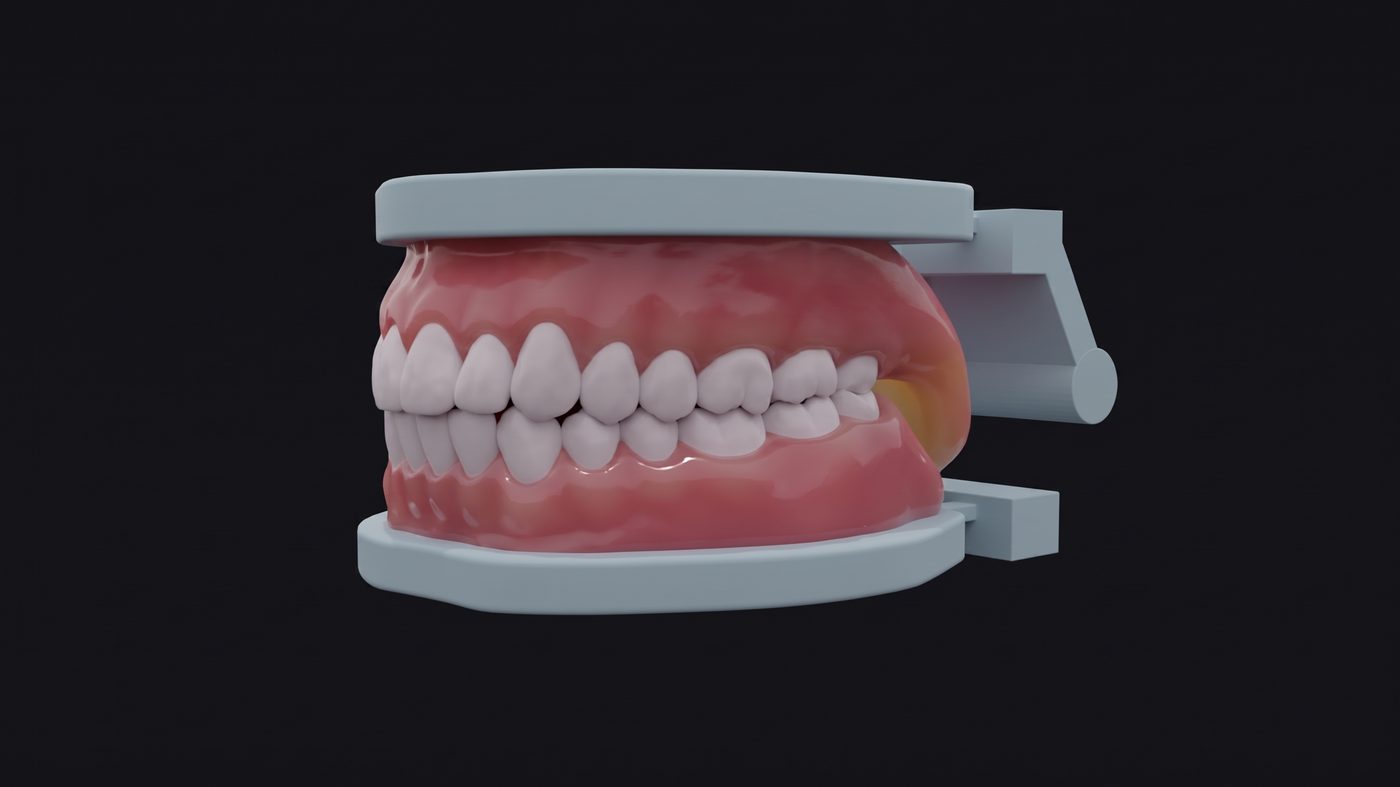 Side profile of the model with hinge open