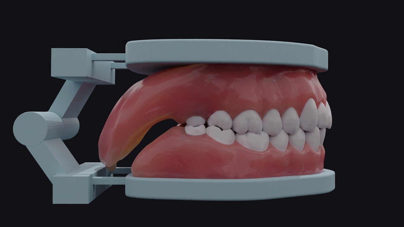 Side view of the model with the bite closed, hinge visible