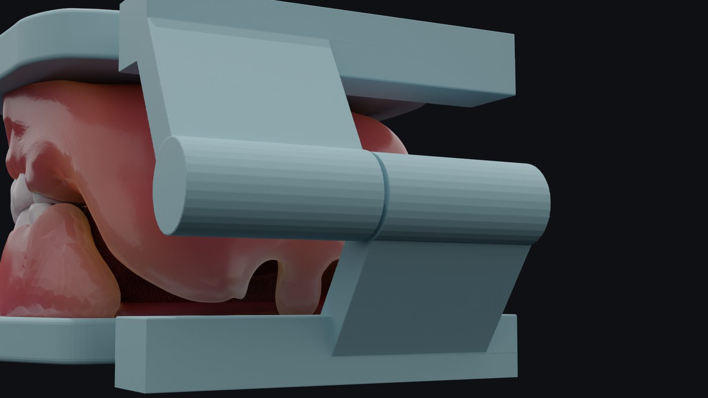 Close-up of the tool-free, lego-style hinge attachment