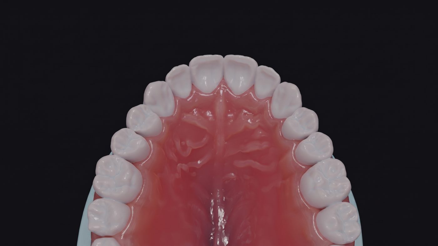 Close-up of the sculpted palate rugae on the upper arch
