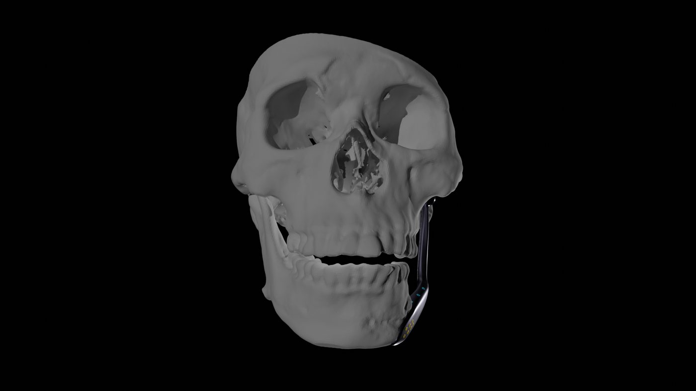 Front view of the skull with the mouth closed, showing the joint mechanism along one side