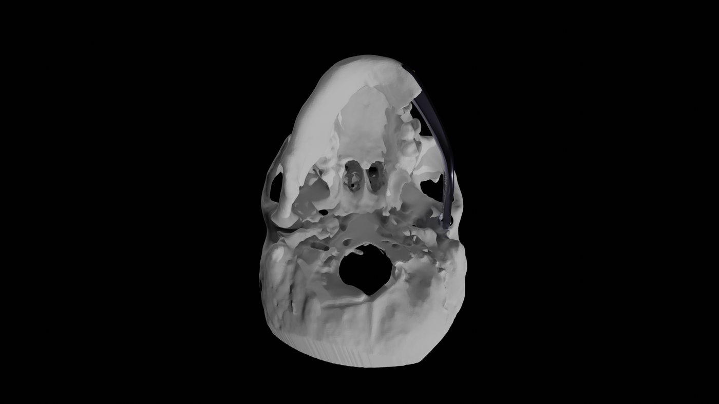 Superior view of the skull showing the joint mechanism from above