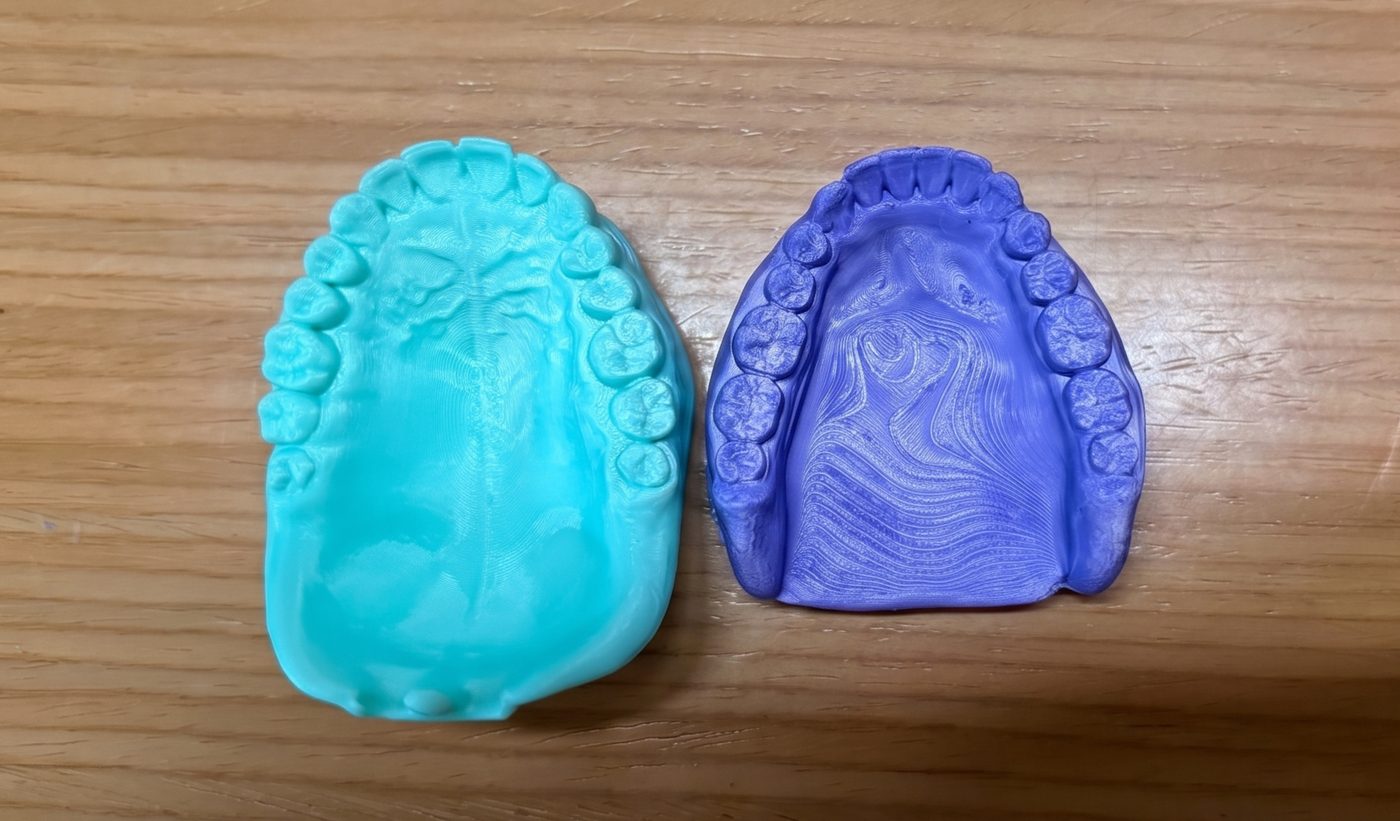 3D-printed upper and lower arches of the model in teal and purple resin, showing the palate and teeth detail before assembly